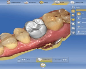 digital teeth